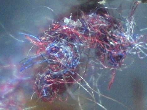 http://i994.photobucket.com/albums/af70/ILoveCasperTheGhost/morgellons.color_zpslwnkkajc.jpg